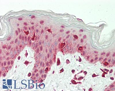 CTDP1 / FCP1 Antibody - Human Skin: Formalin-Fixed, Paraffin-Embedded (FFPE)