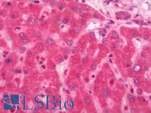 CTDSP1 / SCP1 Antibody - Human Liver: Formalin-Fixed, Paraffin-Embedded (FFPE)