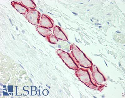 CTDSP1 / SCP1 Antibody - Human Tonsil, Skeletal Myocytes: Formalin-Fixed, Paraffin-Embedded (FFPE)