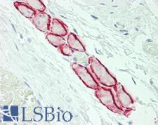 CTDSP1 / SCP1 Antibody - Human Tonsil, Skeletal Myocytes: Formalin-Fixed, Paraffin-Embedded (FFPE)