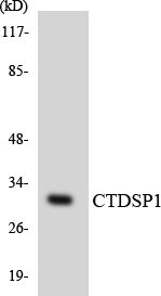CTDSP1 / SCP1 Antibody - Western blot analysis of the lysates from HepG2 cells using CTDSP1 antibody.