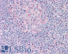 CTDSP1 / SCP1 Antibody - Anti-CTDSP1 / SCP1 antibody IHC staining of human tonsil. Immunohistochemistry of formalin-fixed, paraffin-embedded tissue after heat-induced antigen retrieval.