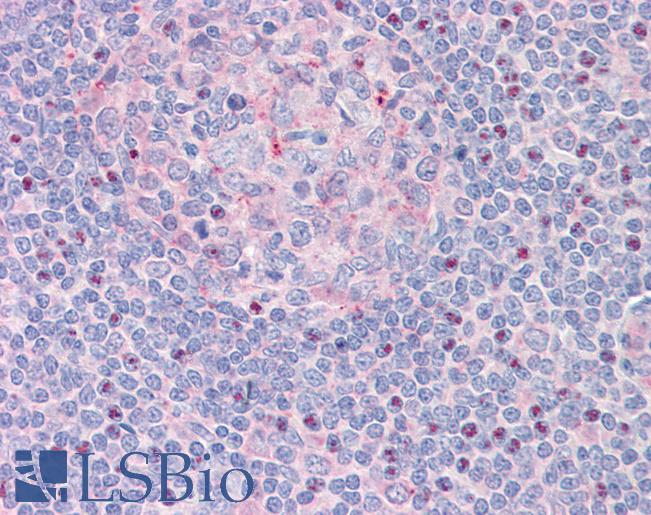 CTDSP1 / SCP1 Antibody - Anti-CTDSP1 / SCP1 antibody IHC staining of human tonsil. Immunohistochemistry of formalin-fixed, paraffin-embedded tissue after heat-induced antigen retrieval.