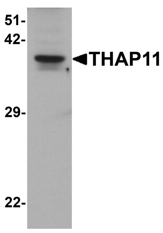 CTG-B45d / THAP11 Antibody - Western blot analysis of THAP11 in human brain tissue lysate with THAP11 antibody at 1 ug/ml.