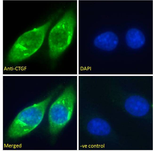 CTGF Antibody - Immunofluorescence analysis of paraformaldehyde fixed HepG2 cells, permeabilized with 0.15% Triton. Primary incubation 1hr (10ug/ml) followed by Alexa Fluor 488 secondary antibody (2ug/ml), showing cytoplasmic staining. The nuclear stain is DAPI (blue). Negative control: Unimmunized goat IgG (10ug/ml) followed by Alexa Fluor 488 secondary antibody (2ug/ml).