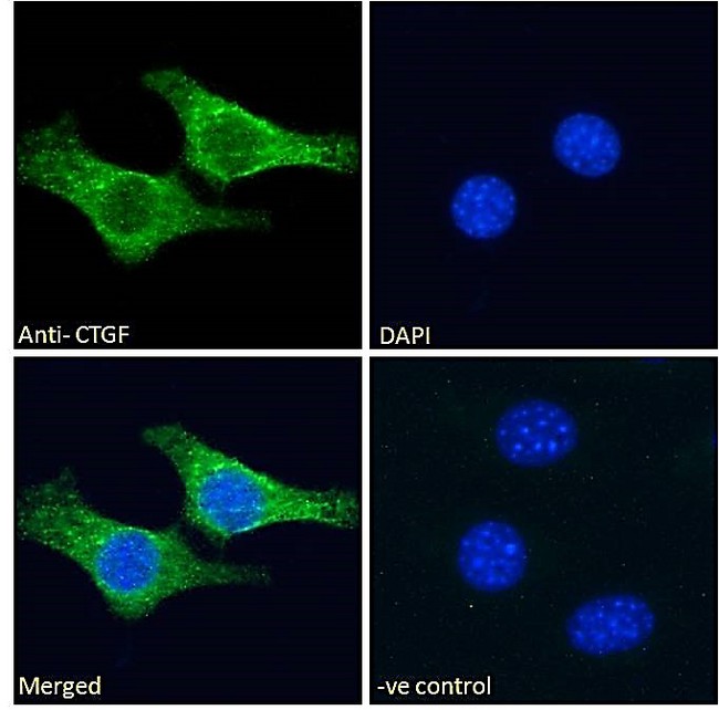 CTGF Antibody - CTGF (aa111-123) Antibody Immunofluorescence analysis of paraformaldehyde fixed NIH3T3 cells, permeabilized with 0.15% Triton. Primary incubation 1hr (10ug/ml) followed by Alexa Fluor 488 secondary antibody (2ug/ml), showing cytoplasmic staining. The nuclear stain is DAPI (blue). Negative control: Unimmunized goat IgG (10ug/ml) followed by Alexa Fluor 488 secondary antibody (2ug/ml).