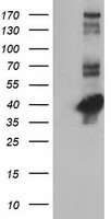 CTH / Cystathionase Antibody - HEK293T cells were transfected with the pCMV6-ENTRY control (Left lane) or pCMV6-ENTRY CTH (Right lane) cDNA for 48 hrs and lysed. Equivalent amounts of cell lysates (5 ug per lane) were separated by SDS-PAGE and immunoblotted with anti-CTH.