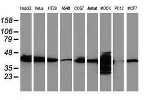 CTH / Cystathionase Antibody - Western blot of extracts (35ug) from 9 different cell lines by using anti-CTH monoclonal antibody (HepG2: human; HeLa: human; SVT2: mouse; A549: human; COS7: monkey; Jurkat: human; MDCK: canine; PC12: rat; MCF7: human).