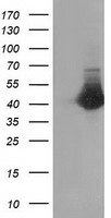 CTH / Cystathionase Antibody - HEK293T cells were transfected with the pCMV6-ENTRY control (Left lane) or pCMV6-ENTRY CTH (Right lane) cDNA for 48 hrs and lysed. Equivalent amounts of cell lysates (5 ug per lane) were separated by SDS-PAGE and immunoblotted with anti-CTH.