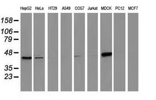 CTH / Cystathionase Antibody - Western blot of extracts (35 ug) from 9 different cell lines by using anti-CTH monoclonal antibody (HepG2: human; HeLa: human; SVT2: mouse; A549: human; COS7: monkey; Jurkat: human; MDCK: canine; PC12: rat; MCF7: human).