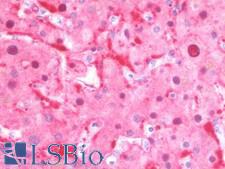 CTH / Cystathionase Antibody - Anti-CTH antibody IHC staining of human liver. Immunohistochemistry of formalin-fixed, paraffin-embedded tissue after heat-induced antigen retrieval. Antibody concentration 10 ug/ml.