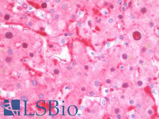 CTH / Cystathionase Antibody - Anti-CTH antibody IHC staining of human liver. Immunohistochemistry of formalin-fixed, paraffin-embedded tissue after heat-induced antigen retrieval. Antibody concentration 10 ug/ml.