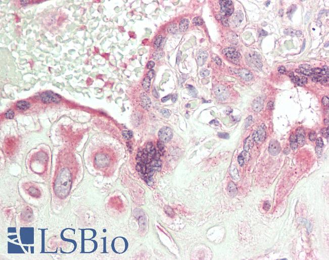 CTHRC1 Antibody - Human Placenta: Formalin-Fixed, Paraffin-Embedded (FFPE)