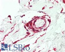 CTHRC1 Antibody - Anti-CTHRC1 antibody IHC staining of human vessel. Immunohistochemistry of formalin-fixed, paraffin-embedded tissue after heat-induced antigen retrieval.