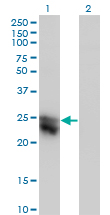 CTHRC1 Antibody - Western blot of CTHRC1 expression in transfected 293T cell line by CTHRC1 monoclonal antibody (M05), clone 1G12.
