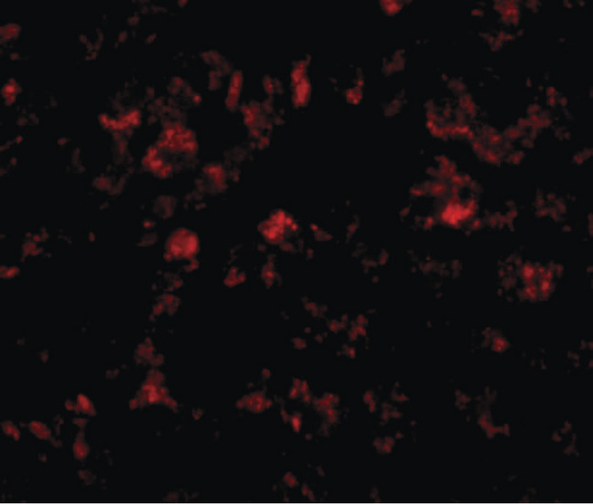 CTMP / THEM4 Antibody - Immunofluorescence of THEM4 in human liver tissue with THEM4 antibody at 20 ug/ml.