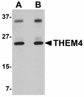 CTMP / THEM4 Antibody - Western blot of THEM4 in human liver tissue lysate with THEM4 antibody at (A) 1 and (B) 2 ug/ml. 