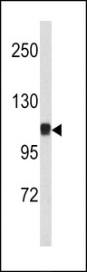 CTNNA1 / Catenin Alpha-1 Antibody - Western blot of CTNA1 antibody in mouse bladder tissue lysates (35 ug/lane). CTNA1 (arrow) was detected using the purified antibody.