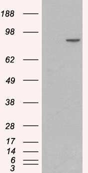CTNNA1 / Catenin Alpha-1 Antibody - HEK293 overexpressing Human CTNNA1 (RC201766) and probed with (mock transfection in first lane).