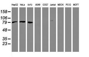 CTNNB1 / Beta Catenin Antibody - Western blot of extracts (35 ug) from 9 different cell lines by using anti-CTNNB1 monoclonal antibody.