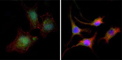 CTNNB1 / Beta Catenin Antibody - Immunofluorescence of A549 (left) and SK-BR-3 (right) cells using CTNNB1 mouse monoclonal antibody (green). Red: Actin filaments have been labeled with DY-554 phalloidin. Blue: DRAQ5 fluorescent DNA dye.