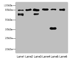 CTNNB1 / Beta Catenin Antibody - Western blot All lanes: CTNNB1 antibody at 7.5ug/ml Lane 1: Hela whole cell lysate Lane 2: U251 whole cell lysate Lane 3: HT29 whole cell lysate Lane 4: Mouse lung tissue Lane 5: Mouse liver tissue Lane 6: Zebrafish lysate Secondary Goat polyclonal to Rabbit IgG at 1/10000 dilution Predicted band size: 86,10 kDa Observed band size: 85,65,37 kDa