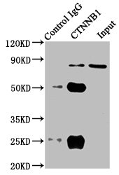 CTNNB1 / Beta Catenin Antibody - Immunoprecipitating CTNNB1 in HT29 whole cell lysate Lane 1: Rabbit control IgG instead of CTNNB1 Antibody in HT29 whole cell lysate.For western blotting, a HRP-conjugated Protein G antibody was used as the secondary antibody (1/5000) Lane 2: CTNNB1 Antibody (8µg) + HT29 whole cell lysate (500µg) Lane 3: HT29 whole cell lysate (20µg)