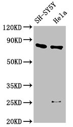 CTNNB1 / Beta Catenin Antibody - Western Blot Positive WB detected in: SH-SY5Y whole cell lysate, Hela whole cell lysate All lanes: CTNNB1 antibody at 2.5µg/ml Secondary Goat polyclonal to rabbit IgG at 1/50000 dilution Predicted band size: 86 kDa Observed band size: 86 kDa