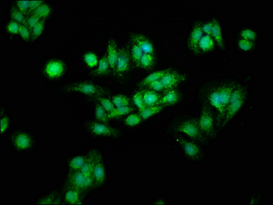 CTNNB1 / Beta Catenin Antibody - Immunofluorescence staining of HepG2 cells with CTNNB1 Antibody at 1:166, counter-stained with DAPI. The cells were fixed in 4% formaldehyde, permeabilized using 0.2% Triton X-100 and blocked in 10% normal Goat Serum. The cells were then incubated with the antibody overnight at 4°C. The secondary antibody was Alexa Fluor 488-congugated AffiniPure Goat Anti-Rabbit IgG(H+L).