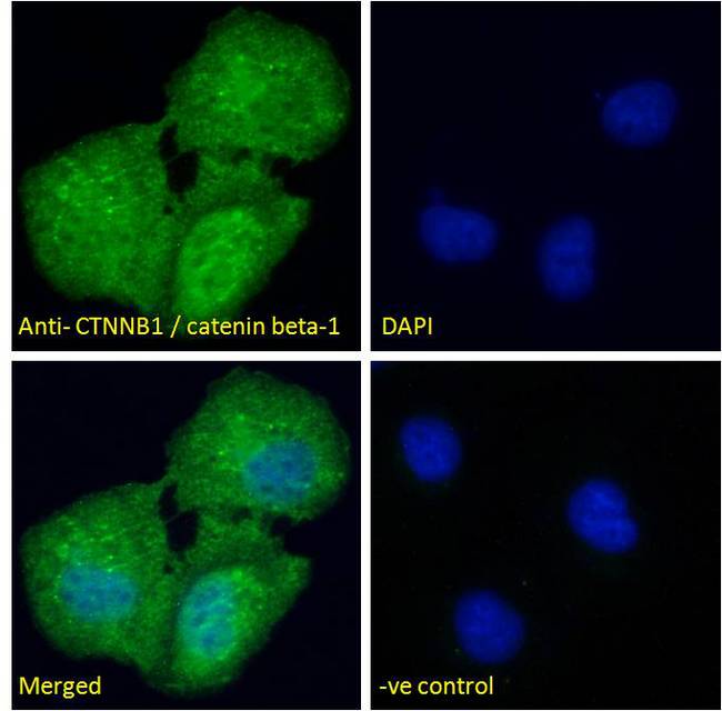 CTNNB1 / Beta Catenin Antibody - CTNNB1 / Beta Catenin antibody immunofluorescence analysis of paraformaldehyde fixed U2OS cells, permeabilized with 0.15% Triton. Primary incubation 1hr (10ug/ml) followed by Alexa Fluor 488 secondary antibody (4ug/ml), showing cytoplasm/Plasma Membrane staining. The nuclear stain is DAPI (blue). Negative control: Unimmunized goat IgG (10ug/ml) followed by Alexa Fluor 488 secondary antibody (2ug/ml).