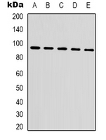CTNNB1 / Beta Catenin Antibody - Western blot analysis of Beta-catenin expression in HeLa (A); 293T (B); MCF7 (C); mouse brain (D); rat liver (E) whole cell lysates.