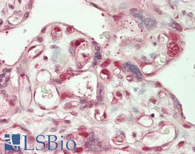 CTNNBL1 / NAP Antibody - Human Placenta: Formalin-Fixed, Paraffin-Embedded (FFPE)