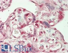 CTNNBL1 / NAP Antibody - Human Placenta: Formalin-Fixed, Paraffin-Embedded (FFPE)