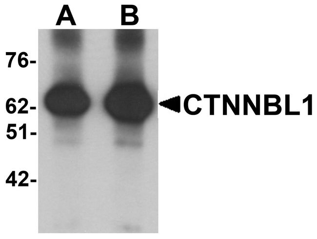 CTNNBL1 / NAP Antibody - Western blot analysis of CTNNBL1 in human brain tissue lysate with CTNNBL1 antibody at (A) 1 and (B) 2 ug/ml.