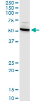 CTNS / Cystinosin Antibody - CTNS monoclonal antibody (M09), clone 5G6. Western Blot analysis of CTNS expression in human liver.