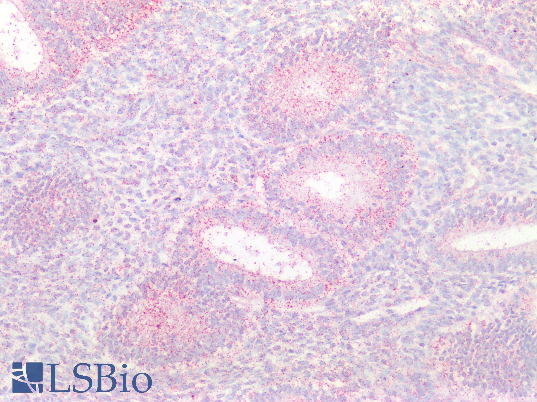 CTSB / Cathepsin B Antibody - Human Uterus: Formalin-Fixed, Paraffin-Embedded (FFPE)