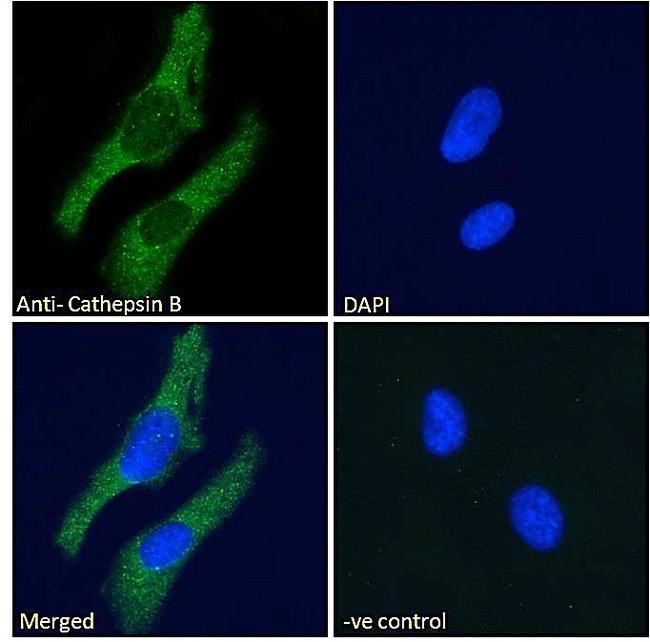CTSB / Cathepsin B Antibody - Immunofluorescence analysis of paraformaldehyde fixed HeLa cells, permeabilized with 0.15% Triton. Primary incubation 1hr (10ug/ml) followed by Alexa Fluor 488 secondary antibody (2ug/ml), showing vesicle/cytoplasmic staining. The nuclear stain is DAPI (blue). Negative control: Unimmunized goat IgG (10ug/ml) followed by Alexa Fluor 488 secondary antibody (2ug/ml).