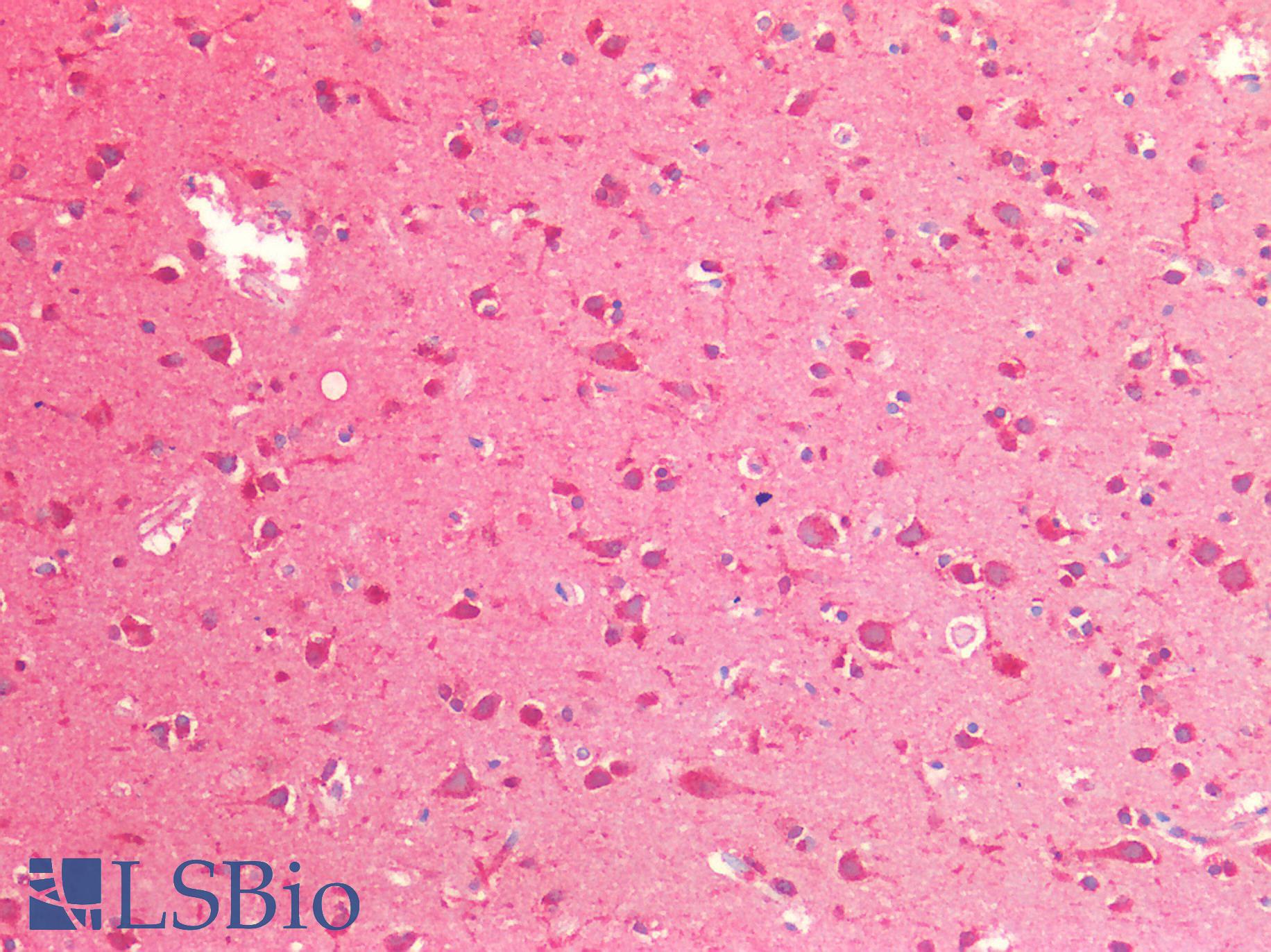 CTSB / Cathepsin B Antibody - Human Brain, Cortex: Formalin-Fixed, Paraffin-Embedded (FFPE)
