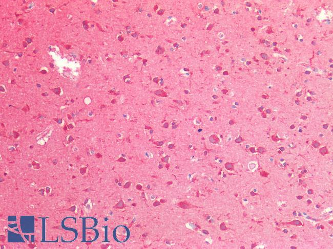 CTSB / Cathepsin B Antibody - Human Brain, Cortex: Formalin-Fixed, Paraffin-Embedded (FFPE)
