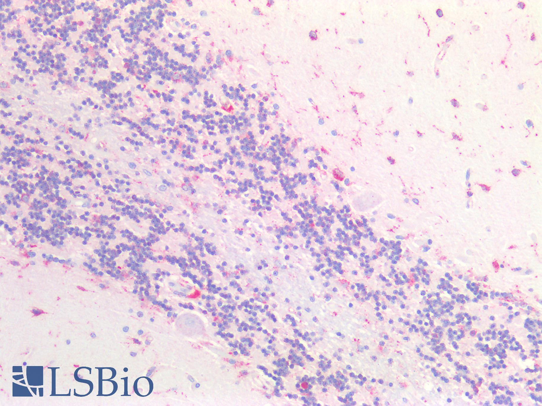 CTSB / Cathepsin B Antibody - Human Brain, Cerebellum: Formalin-Fixed, Paraffin-Embedded (FFPE)