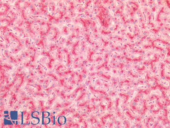 CTSB / Cathepsin B Antibody - Human Liver: Formalin-Fixed, Paraffin-Embedded (FFPE)