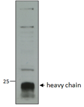 CTSC / Cathepsin C / JP Antibody - CTSC / Cathepsin C / JP antibody (1µg/ml) staining of Human Neutrophils lysate (35µg protein in RIPA buffer). Data obtained from a customer. Detected by chemiluminescence.