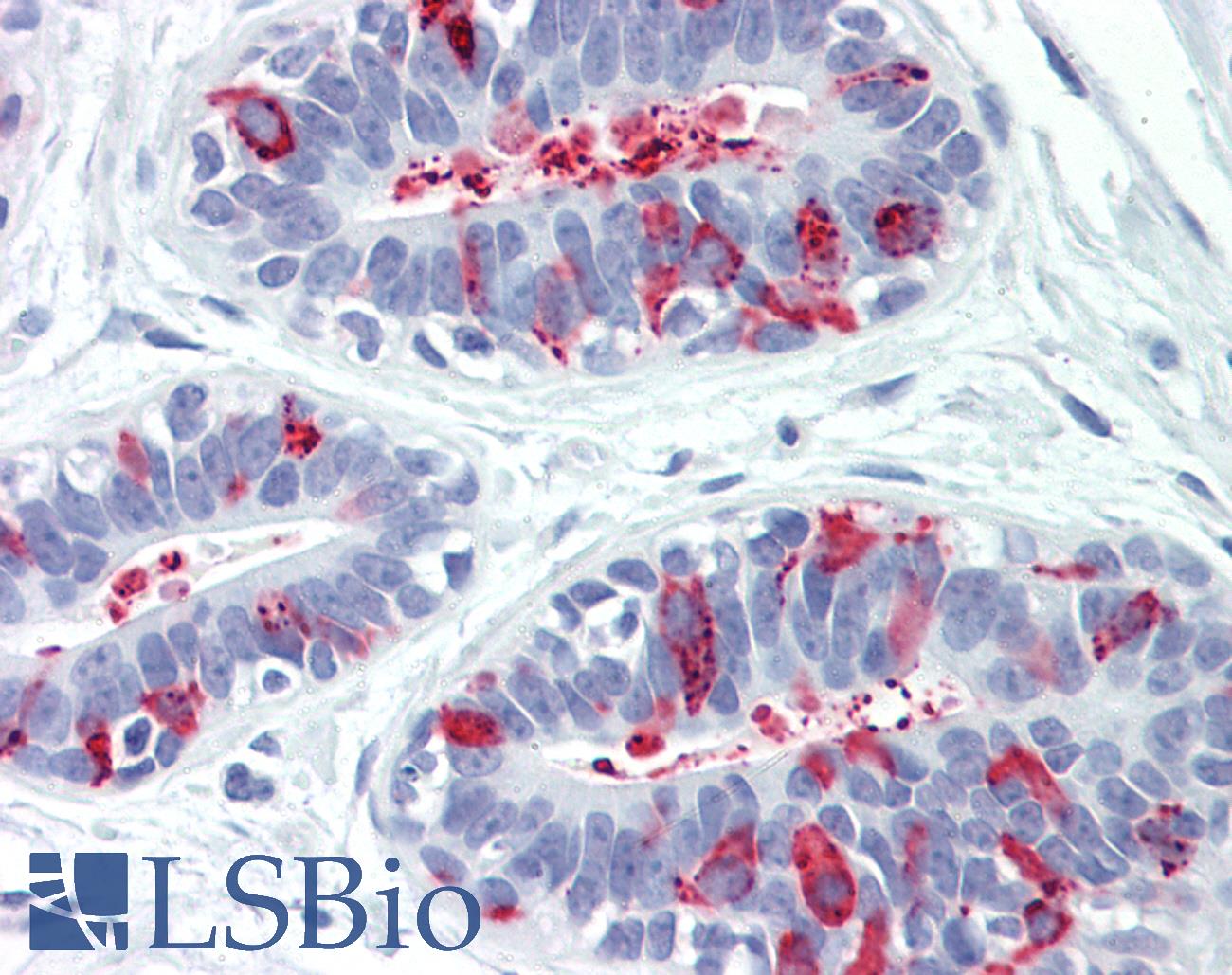 CTSC / Cathepsin C / JP Antibody - Human Breast: Formalin-Fixed, Paraffin-Embedded (FFPE)