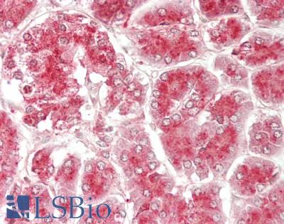 CTSD / Cathepsin D Antibody - Human Placenta: Formalin-Fixed, Paraffin-Embedded (FFPE)
