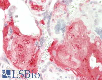 CTSD / Cathepsin D Antibody - Human Placenta: Formalin-Fixed, Paraffin-Embedded (FFPE)