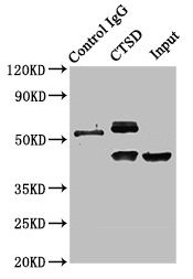 CTSD / Cathepsin D Antibody - Immunoprecipitating CTSD in HepG2 whole cell lysate Lane 1: Rabbit control IgG instead of CTSD Antibody in HepG2 whole cell lysate.For western blotting, a HRP-conjugated Protein G antibody was used as the secondary antibody (1/2000) Lane 2: CTSD Antibody (8µg) + HepG2 whole cell lysate (500µg) Lane 3: HepG2 whole cell lysate (10µg)
