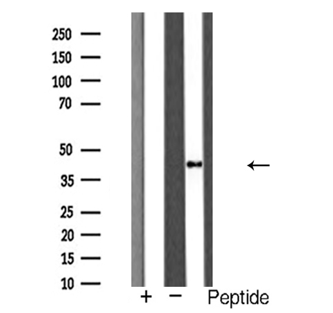 CTSD / Cathepsin D Antibody - Western blot analysis of Cathepsin D expression in HepG2 cells