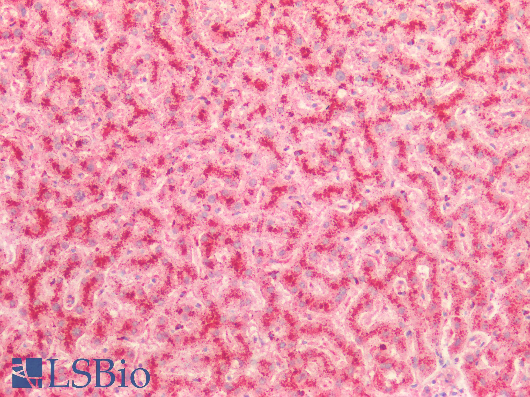 CTSD / Cathepsin D Antibody - Human Liver: Formalin-Fixed, Paraffin-Embedded (FFPE)