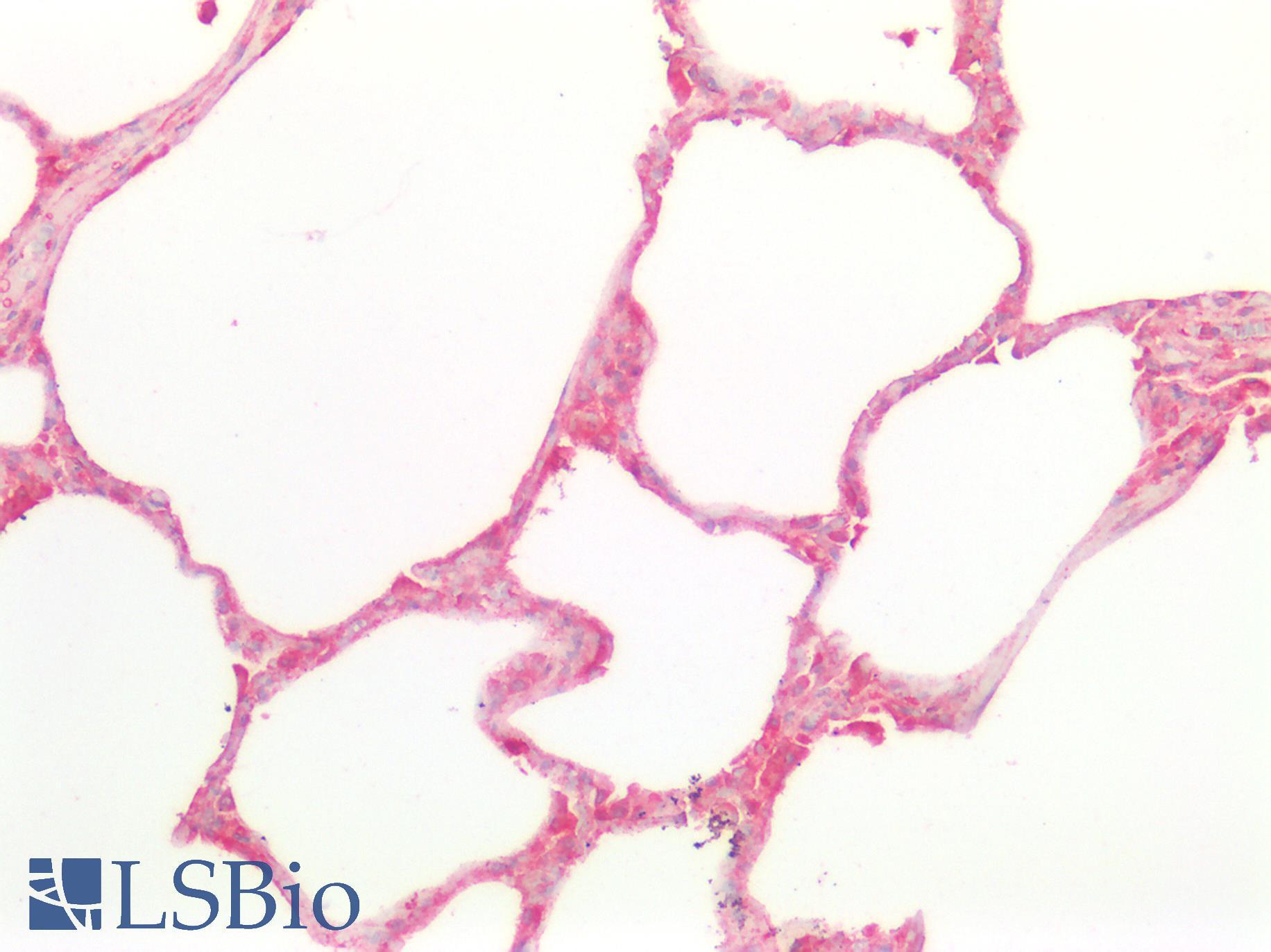 CTSD / Cathepsin D Antibody - Human Lung: Formalin-Fixed, Paraffin-Embedded (FFPE)