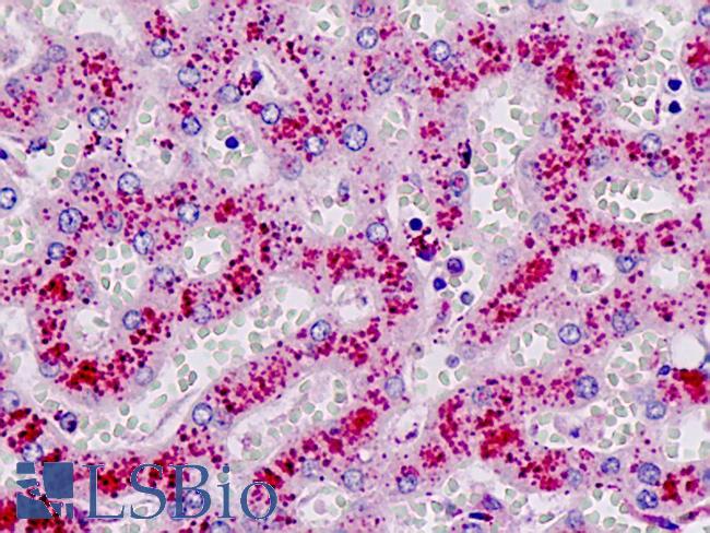 CTSD / Cathepsin D Antibody - Anti-CTSD / Cathepsin D antibody IHC staining of human liver. Immunohistochemistry of formalin-fixed, paraffin-embedded tissue after heat-induced antigen retrieval.